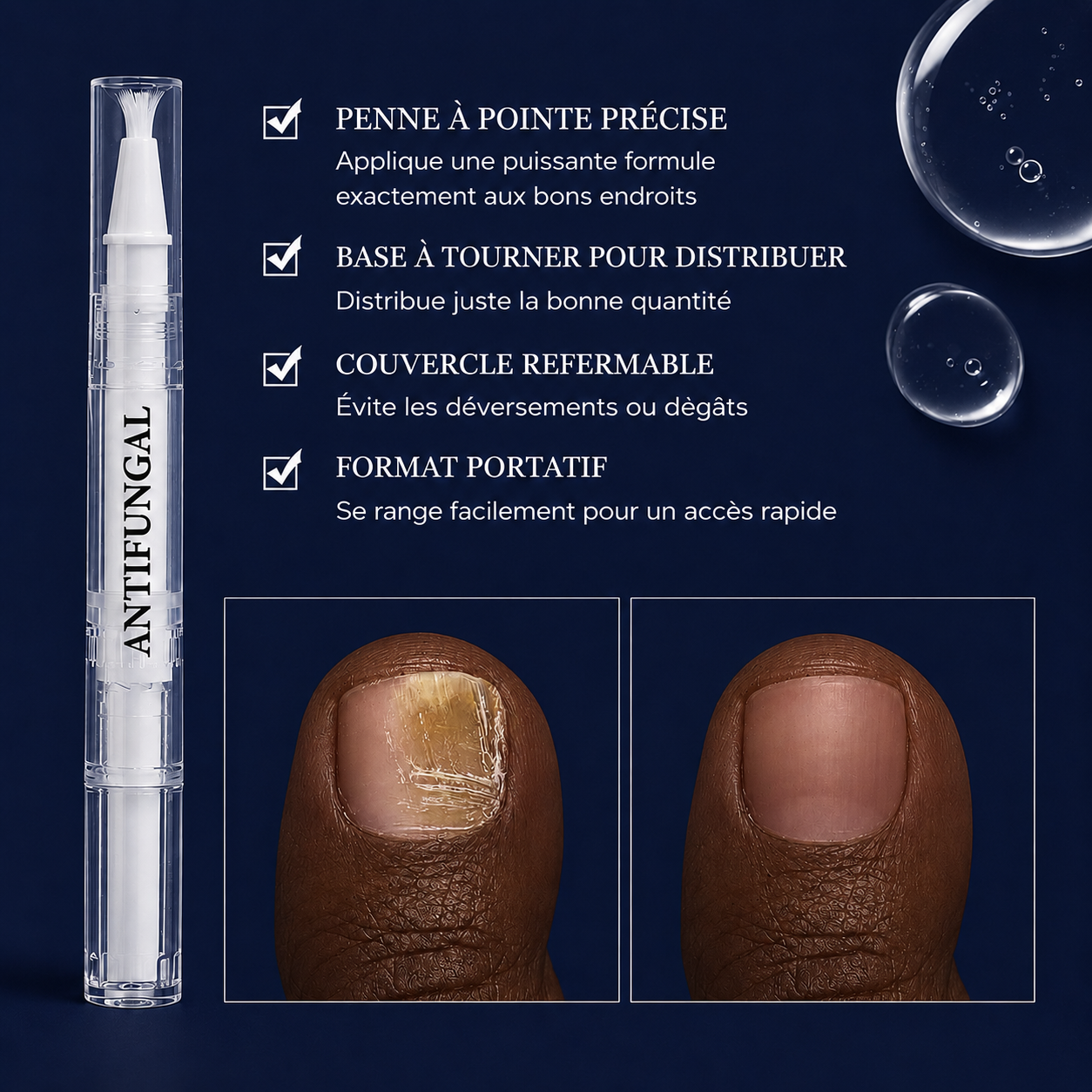 Stylo Antifongique NailCare™ : Des ongles sains en quelques jours