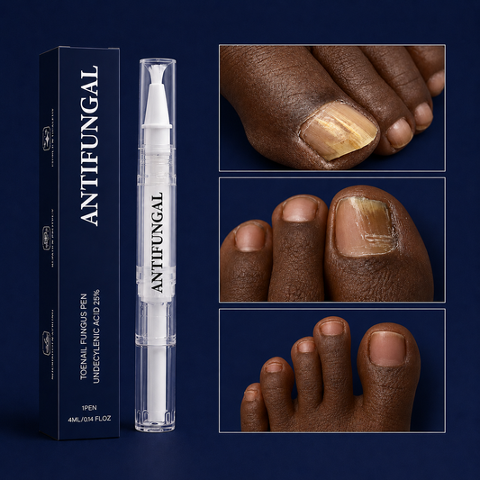 Stylo Antifongique NailCare™ : Des ongles sains en quelques jours